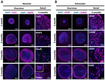 Varicella-zoster virus recapitulates its immune evasive behaviour in matured hiPSC-derived neurospheroids